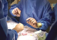 organ transplants coming to pindi