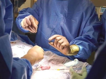 organ transplants coming to pindi