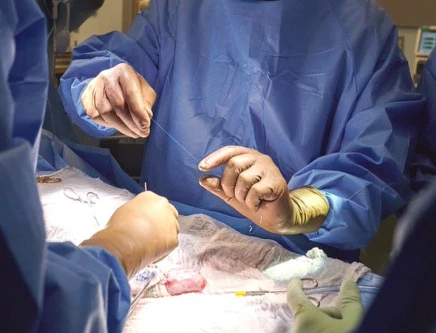 organ transplants coming to pindi