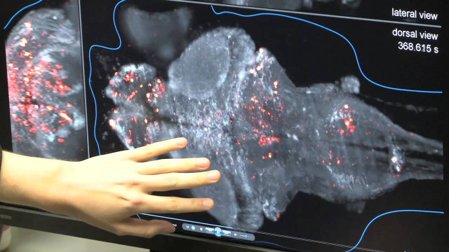 flashes of insight whole brain imaging of neural activity in the zebrafish photo youtube screen grab