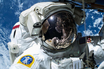 astronaut vision may be impaired by spinal fluid changes study