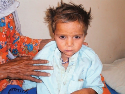 health threat nine children dead in zhob measles outbreak