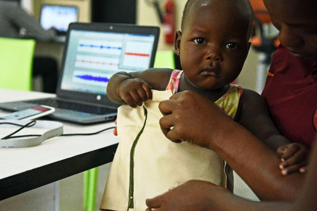 the quot mama ope quot mother 039 s hope kit invented by ugandan engineers is a biomedical smart jacket and a mobile phone app that diagnoses pneumonia faster than a doctor photo afp the quot mama ope quot mother 039 s hope kit invented by ugandan engineers is a biomedical smart jacket and a mobile phone app that diagnoses pneumonia faster than a doctor photo afp