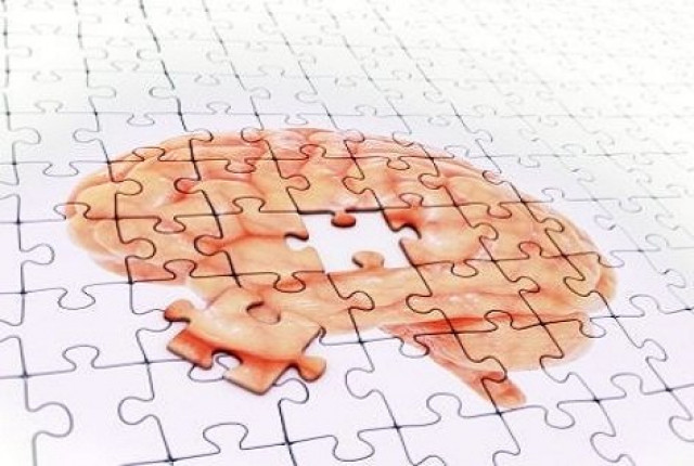 researchers are cautious because mouse models of alzheimer 039 s are not exactly the same as the disease that affects humans photo afp researchers are cautious because mouse models of alzheimer 039 s are not exactly the same as the disease that affects humans photo afp