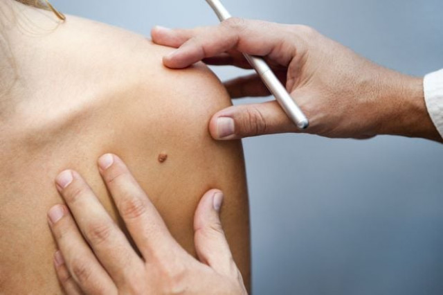 scientists create biodegradable material to improve wound healing skin regeneration scientists create biodegradable material to improve wound healing skin regeneration