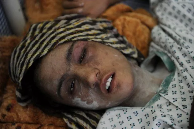 the 23 year old victim zarina was attacked on tuesday evening in balkh province photo afp the 23 year old victim zarina was attacked on tuesday evening in balkh province photo afp
