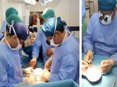 pkli marks kidney transplant milestone pkli marks kidney transplant milestone