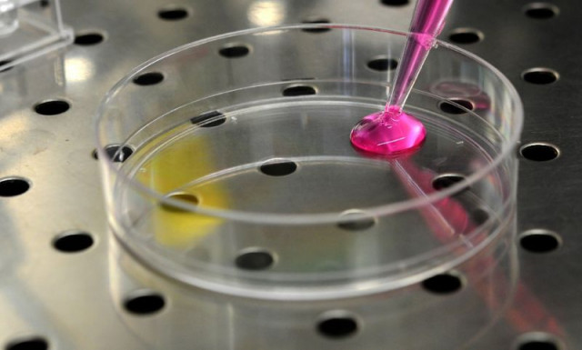 kurian and researchers at the university of michigan based their findings on a survey of more than 2 500 women with stage 0 to stage 2 cancer two months after surgery photo afp kurian and researchers at the university of michigan based their findings on a survey of more than 2 500 women with stage 0 to stage 2 cancer two months after surgery photo afp