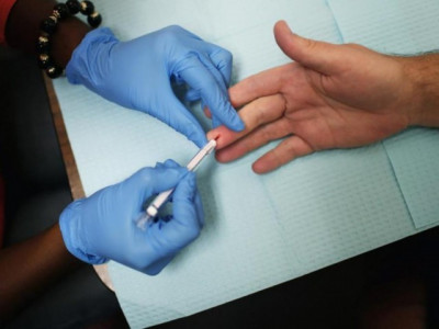 at least five infected with hiv at chinese traditional medicine hospital at least five infected with hiv at chinese traditional medicine hospital