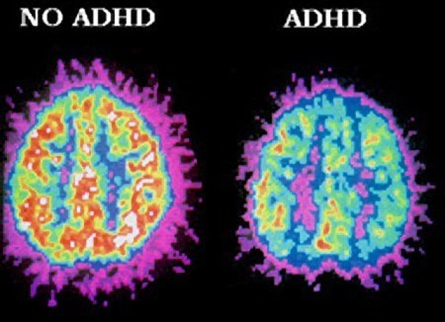 early diagnosis of mental disorder stressed early diagnosis of mental disorder stressed