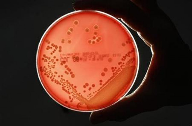 antimicrobial resistance causing 300 000 deaths annually in pakistan