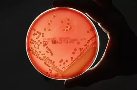 the who has previously warned that many antibiotics could become redundant this century photo reuters the who has previously warned that many antibiotics could become redundant this century photo reuters