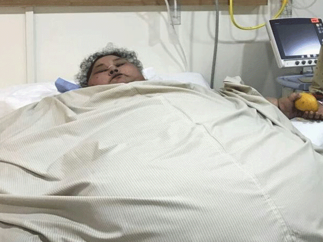 eman ahmed abd el aty before the surgery photo courtesy saifee hospital eman ahmed abd el aty before the surgery photo courtesy saifee hospital