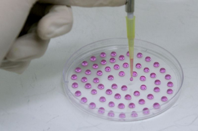 the procedure claimed to use adipose derived stem cells to restore vision photo afp the procedure claimed to use adipose derived stem cells to restore vision photo afp