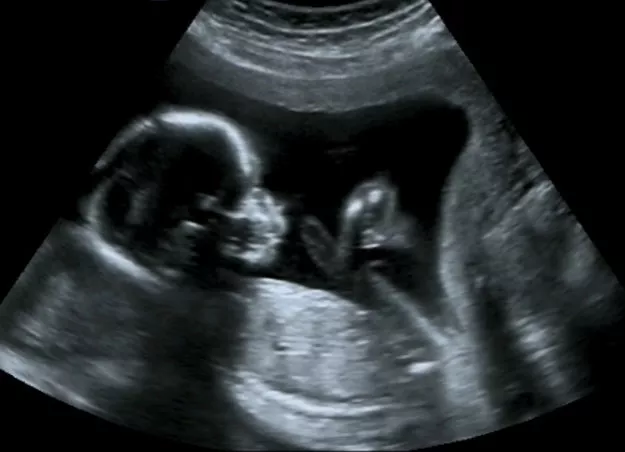 speakers say around 70 of couples not using anything to prevent unwanted pregnancies stock image