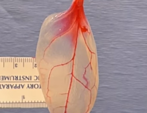 scientists convert spinach leaves into human heart tissue that beats