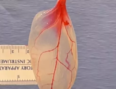 the leaf vascular structure was seeded with heart muscle cells and after a few days of wait the heart cells suddenly contracted mirroring the movement of a human tissue photo screenshot the leaf vascular structure was seeded with heart muscle cells and after a few days of wait the heart cells suddenly contracted mirroring the movement of a human tissue photo screenshot