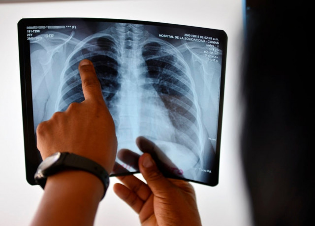 1 8 million died from the bacterial infection in 2015 photo afp 1 8 million died from the bacterial infection in 2015 photo afp