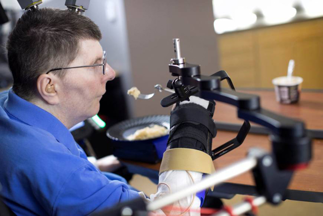 bill kochevar uses computer brain interface technology and an electrical stimulation system to move his arm after eight years of paralysis photo reuters