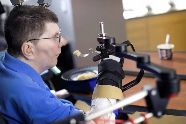 bill kochevar uses computer brain interface technology and an electrical stimulation system to move his arm after eight years of paralysis photo reuters bill kochevar uses computer brain interface technology and an electrical stimulation system to move his arm after eight years of paralysis photo reuters