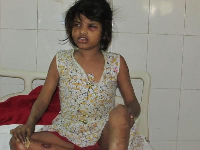 Girl found living with monkeys in Indian forest