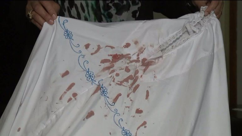 the blood stained scarf of the muslim woman who was attacked photo fox6