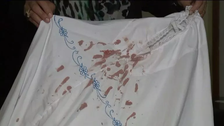 the blood stained scarf of the muslim woman who was attacked photo fox6 the blood stained scarf of the muslim woman who was attacked photo fox6