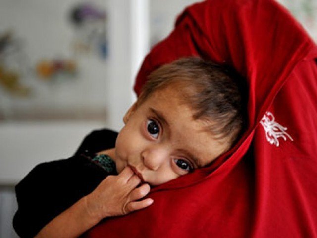 the deaths have raised this year s death toll due to malnutrition in the sindh district to 64 photo afp