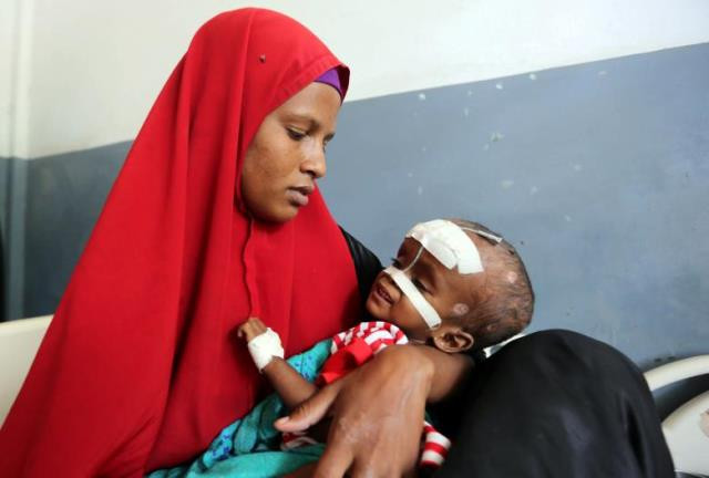 an internally displaced somali woman holds her malnourished child fitted with a nasogastric tube inside a ward dedicated for diarrhoea patients at the banadir hospital in mogadishu somalia photo reuters an internally displaced somali woman holds her malnourished child fitted with a nasogastric tube inside a ward dedicated for diarrhoea patients at the banadir hospital in mogadishu somalia photo reuters