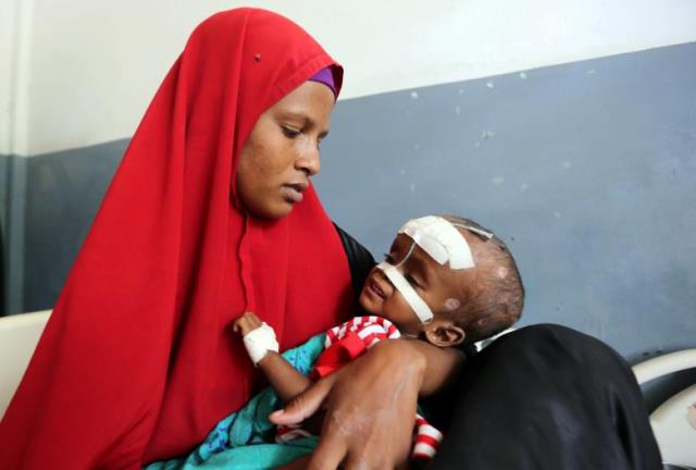 an internally displaced somali woman holds her malnourished child fitted with a nasogastric tube inside a ward dedicated for diarrhoea patients at the banadir hospital in mogadishu somalia photo reuters