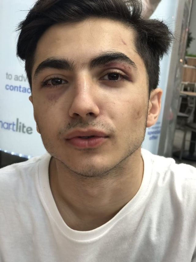 muslim teen s friends surprise him after he became victim of brutal mugging in us