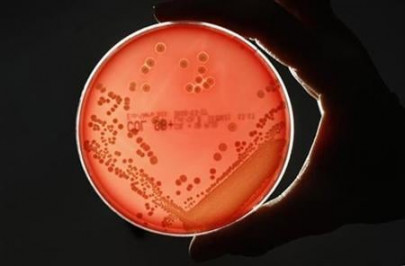 high presence of antibiotic resistant bacterium detected in water