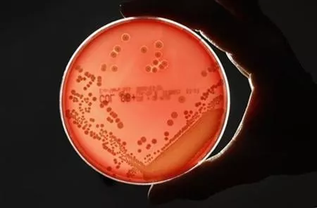 the who has previously warned that many antibiotics could become redundant this century photo reuters the who has previously warned that many antibiotics could become redundant this century photo reuters