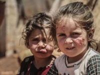 255 leishmania cases reported in south waziristan