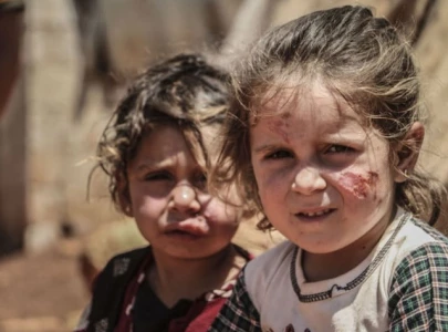 255 leishmania cases reported in south waziristan