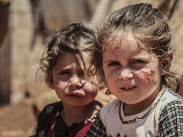 255 Leishmania cases in Lower South Waziristan – Pakistan Today  Pakistan Today