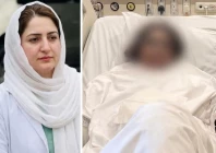 dr mahnoor s first surgery completed after acid attack dr mahnoor s first surgery completed after acid attack