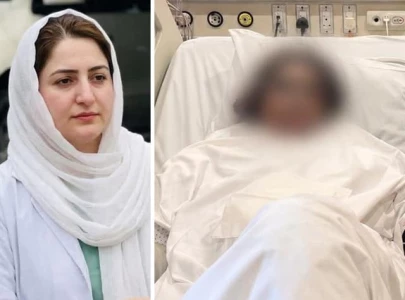 dr mahnoor s first surgery completed after acid attack dr mahnoor s first surgery completed after acid attack