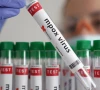 back to back mpox cases put govt on high alert back to back mpox cases put govt on high alert