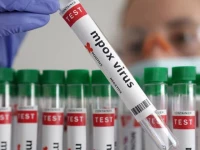 back to back mpox cases put govt on high alert