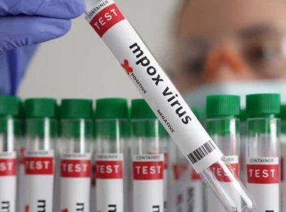 back to back mpox cases put govt on high alert back to back mpox cases put govt on high alert