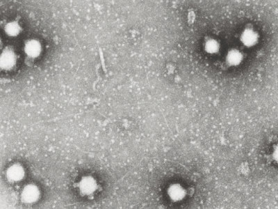 mysterious disease in karak doctors struggling to identify virus which claimed five lives mysterious disease in karak doctors struggling to identify virus which claimed five lives