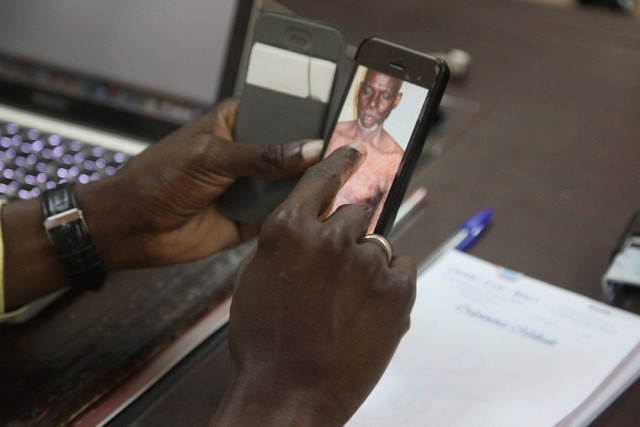 mali has around one dermatologist per million people photo afp mali has around one dermatologist per million people photo afp