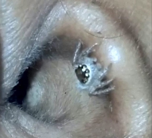 live spider crawled out of indian woman source the sun live spider crawled out of indian woman source the sun