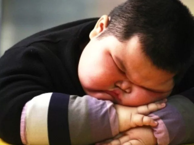 obesity can be the cause of cholesterol sugar high blood pressure paralysis cancer and heart diseases photo reuters obesity can be the cause of cholesterol sugar high blood pressure paralysis cancer and heart diseases photo reuters