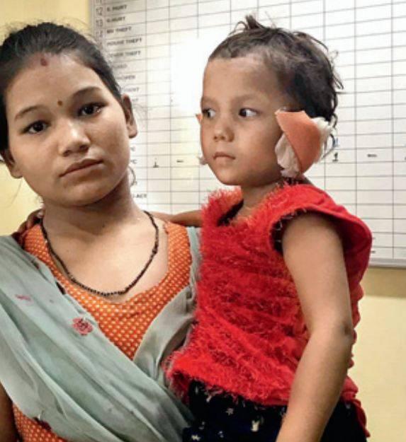 man chops off step daughter 039 s ears photo times of india