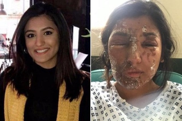 muslim aspiring model severely injured in london acid attack on her 21st birthday