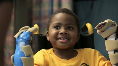 world s first child hand transplant a success