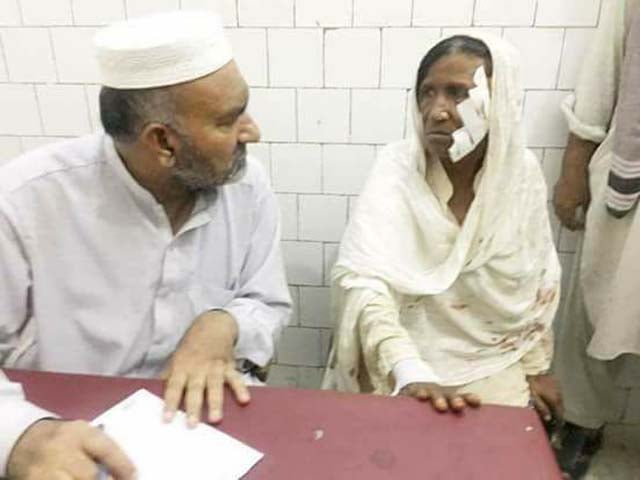 zarsanga sustained severe injuries to her face said her son photo twitter