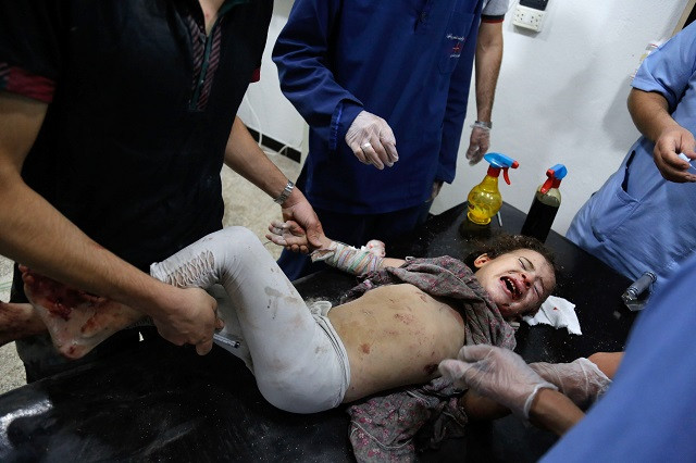 a syrian girl receives treatment at a make shift hospital after she was injured in shelling on the rebel held town of arbin east of the capital late on july 24 2017 women and children were among the dead in the 11 30 pm 2030 gmt strike on arbin in the eastern ghouta rebel enclave where the government declared a ceasefire on july 22 the syrian observatory for human rights said photo afp a syrian girl receives treatment at a make shift hospital after she was injured in shelling on the rebel held town of arbin east of the capital late on july 24 2017 women and children were among the dead in the 11 30 pm 2030 gmt strike on arbin in the eastern ghouta rebel enclave where the government declared a ceasefire on july 22 the syrian observatory for human rights said photo afp
